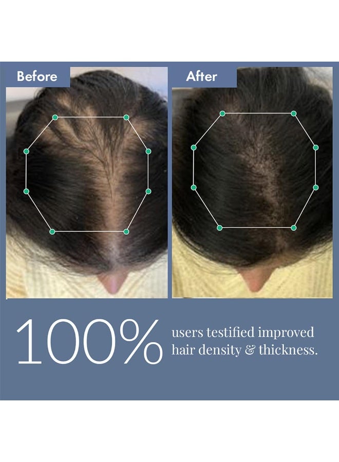 ThriveCo Hair Growth Serum 2.0, 30ml | Advanced Patent Filed Clinically Proven Scalp Treatment for Hair Fall Control & Regrowth | British Medical Publication | Redensyl, Anagain, Regendil®, Rosemary Oil | Lightweight, Non-Sticky Solution | Men & Women - Image 2